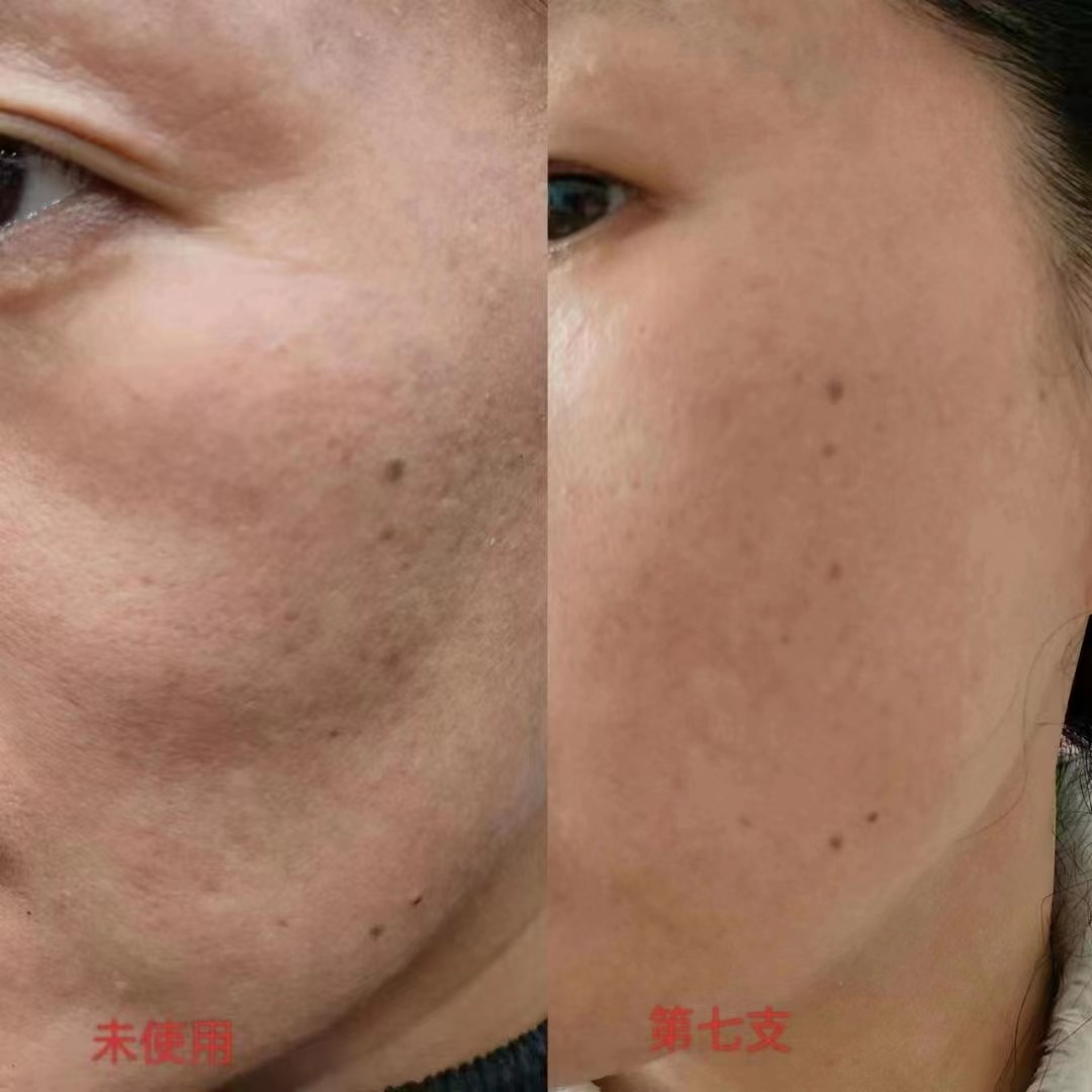 干细胞护肤天花板--零下十八度