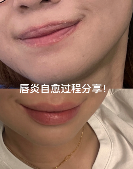 希望每个嘴唇敏感的姐妹都能刷到！安全润唇上岸啦！